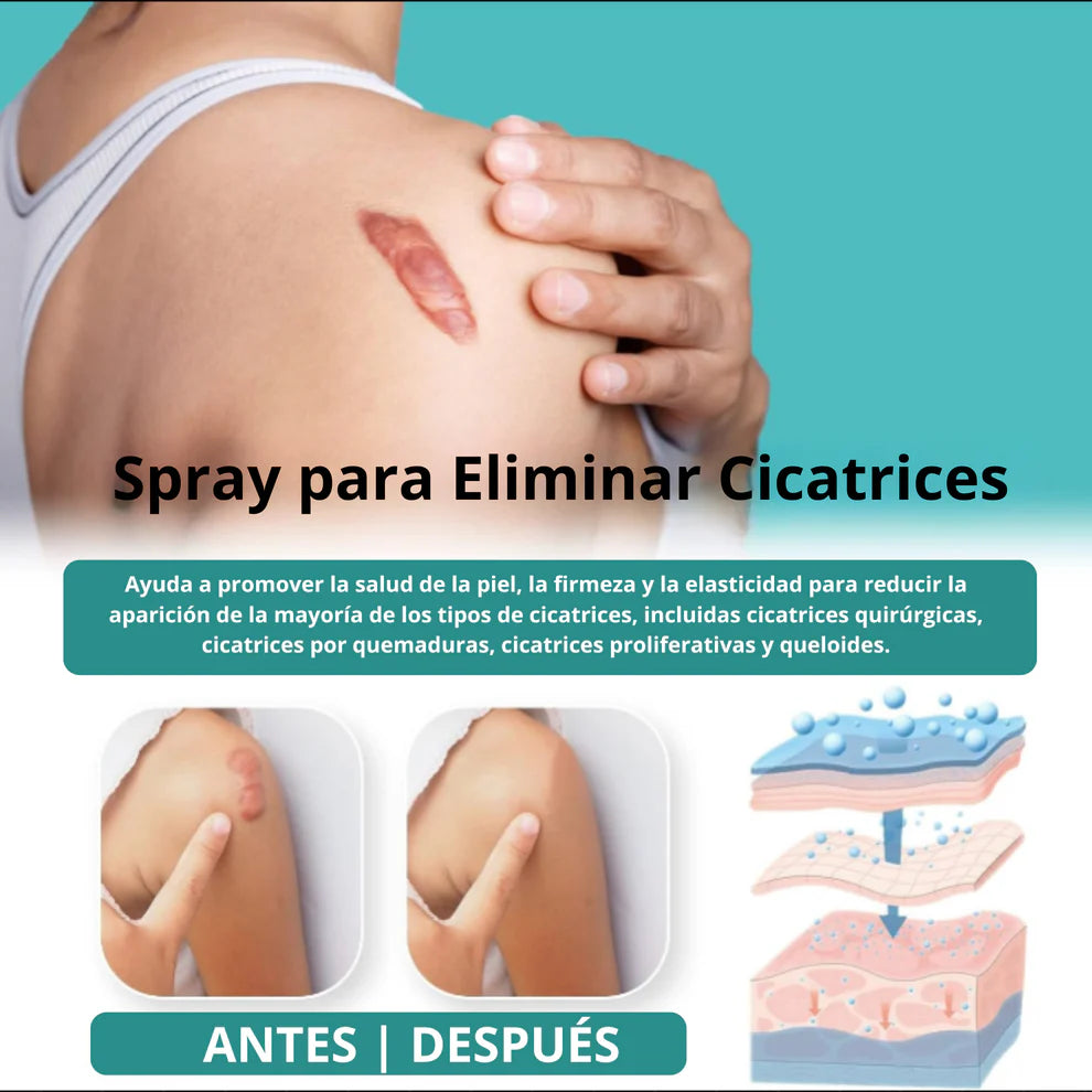 ScarSpray®: Spray avanzado para todo tipo de cicatrices: cicatrices de acné, cicatrices quirúrgicas y estrías
