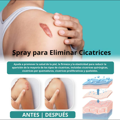 ScarSpray®: Spray avanzado para todo tipo de cicatrices: cicatrices de acné, cicatrices quirúrgicas y estrías
