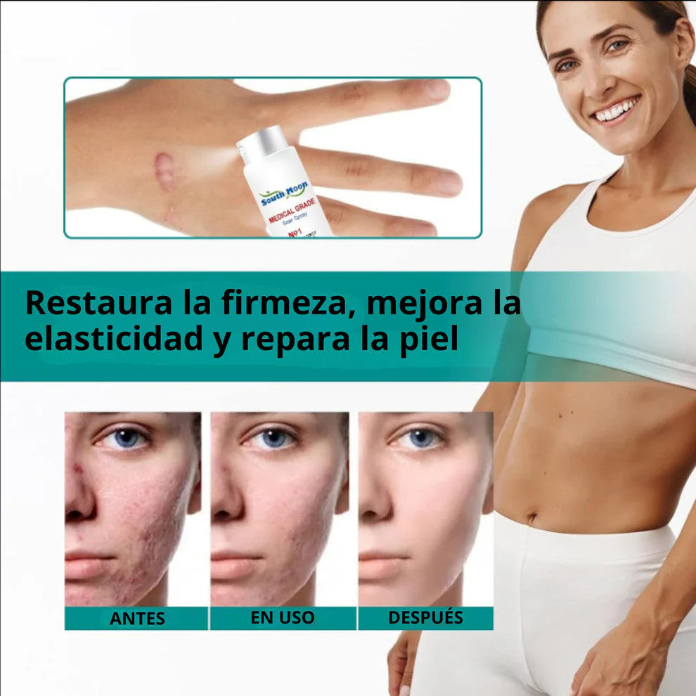 ScarSpray®: Spray avanzado para todo tipo de cicatrices: cicatrices de acné, cicatrices quirúrgicas y estrías